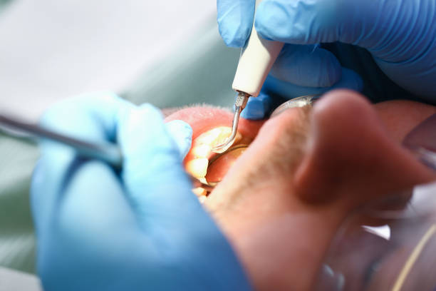 Best Emergency Treatment for Dental Infections or Abscesses in Redfield, AR